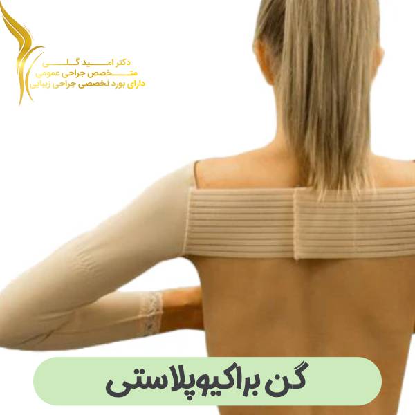 گن براکیوپلاستی