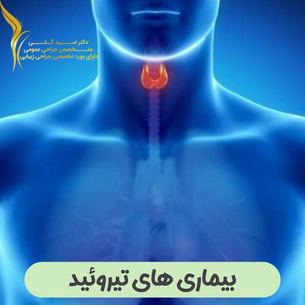 بیماری های تیروئید