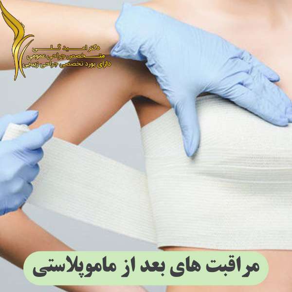 مراقبت ‌های بعد از ماموپلاستی