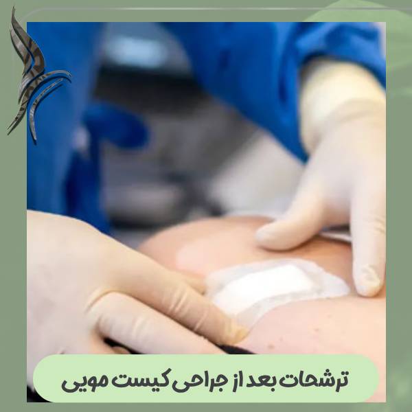 ترشحات بعد از جراحی کیست مویی