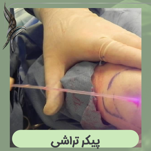 پیکر تراشی