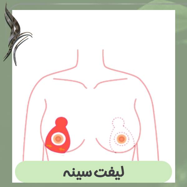 عمل لیفت سینه