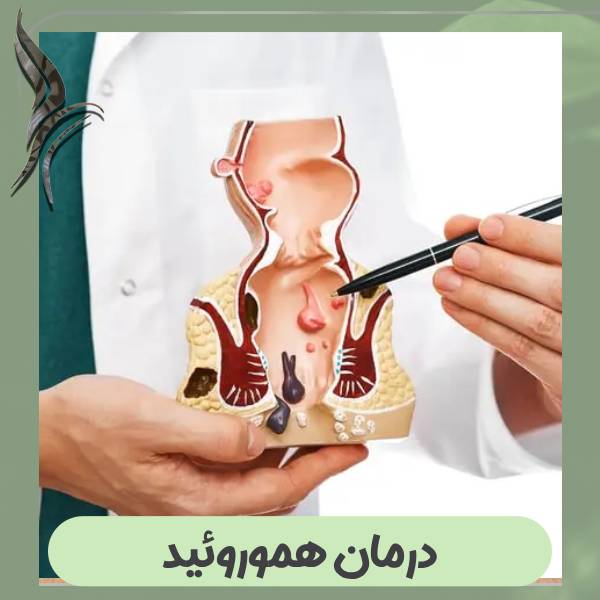 درمان هموروئید با لیزر